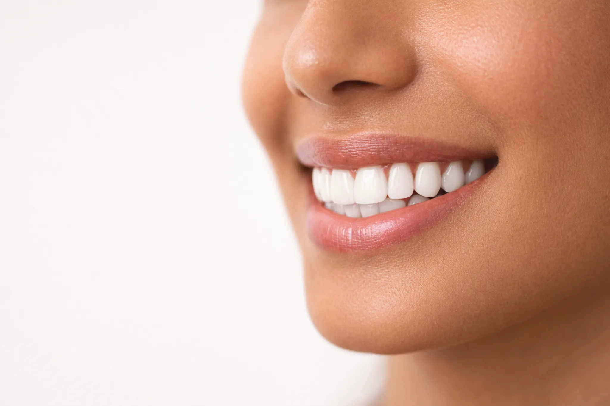 Smile Design Before After